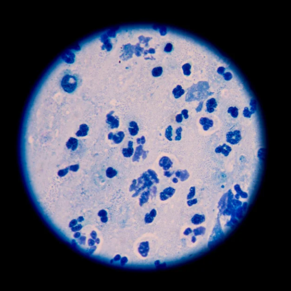 Sputum Microscopy