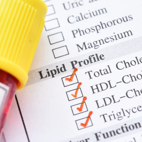 Lipid Profile (Total, HDL, LDL Cholesterols & Triglycerides)