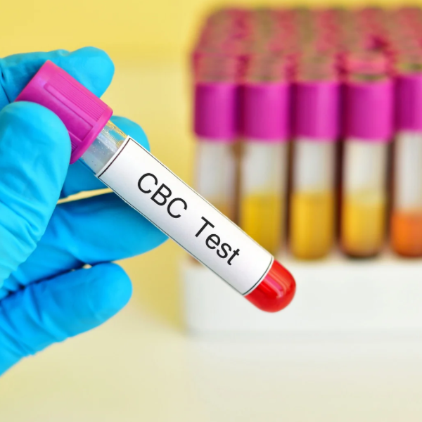 CBC (Complete Blood Count) with Platelet Count