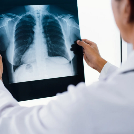 Chest X-Ray
